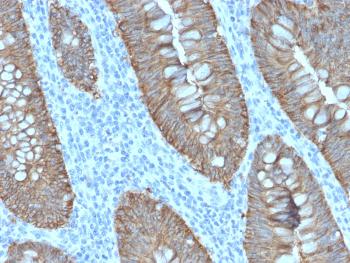 Anti-Ep-CAM / CD326 (Extracellular Domain) (Epithelial Marker) Monoclonal Antibody(Clone: EGP40/2571R)