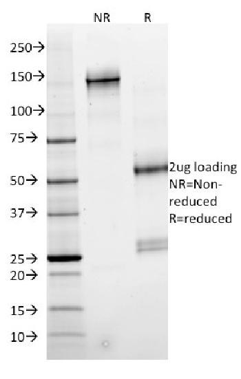 Anti-SMAD4 (Pancreatic Adenocarcinoma Marker) Monoclonal Antibody(Clone: SMAD4/2524)