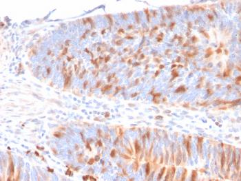 Anti-MBD1 (Methyl-CpG Binding Domain Protein 1) Monoclonal Antibody(Clone: CPTC-MBD1-1)