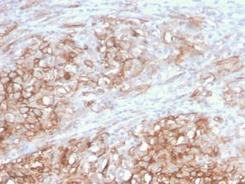 Anti-MCAM (Melanoma Cell Adhesion Molecule) / MUC18 / CD146 Monoclonal Antibody(Clone: MCAM/3046)