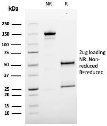 Anti-MCAM (Melanoma Cell Adhesion Molecule) / MUC18 / CD146 Monoclonal Antibody(Clone: MCAM/3179)