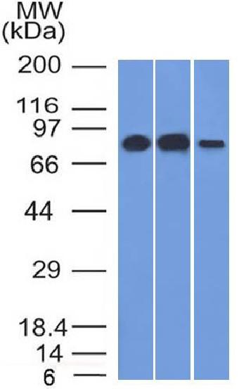 Anti-MCM7 (Proliferation Marker) Monoclonal Antibody(Clone: MCM7/1466)