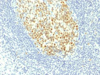 Anti-MCM7 (Proliferation Marker) Monoclonal Antibody(Clone: MCM7/1467)