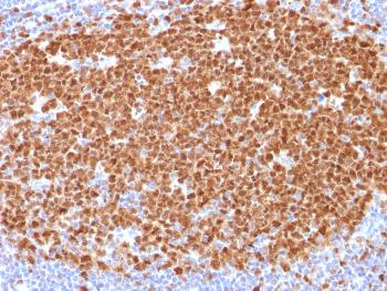 Anti-MCM7 (Proliferation Marker) Monoclonal Antibody(Clone: MCM7/1468)