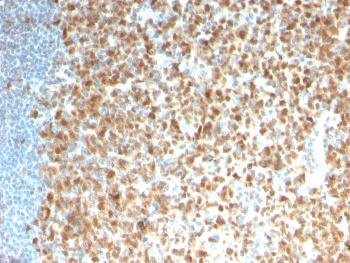 Anti-MCM7 (Proliferation Marker) Monoclonal Antibody(Clone: rMCM7/1468)