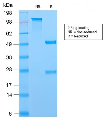 Anti-MCM7 (Proliferation Marker) Monoclonal Antibody(Clone: MCM7/2756R)