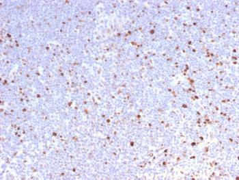 Anti-MCM7 (Proliferation Marker) Monoclonal Antibody(Clone: MCM7/2832R)