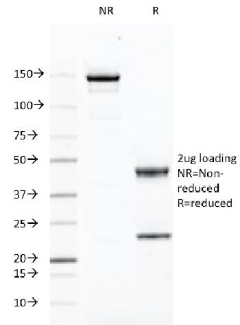 Anti-CD46 (Membrane Cofactor Protein) Monoclonal Antibody(Clone: 169-1-E4.3)