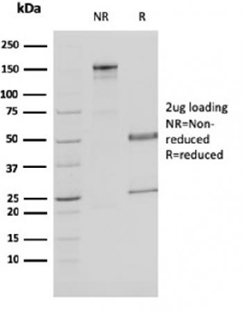 Anti-Malate dehydrogenase 1 NAD (soluble) Monoclonal Antibody(Clone: CPTC-MDH1-1)