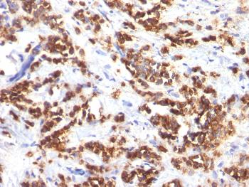 Anti-Milk Fat Globule (Breast Epithelial Marker) Monoclonal Antibody(Clone: MFG-06)