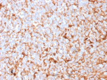 Anti-Mammaglobin (SCGB2A2) (Breast Cancer Marker) Monoclonal Antibody(Clone: MGB1/2682R)