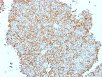 Anti-CD99 / MIC2 (Ewing's Sarcoma Marker) Polyclonal Antibody