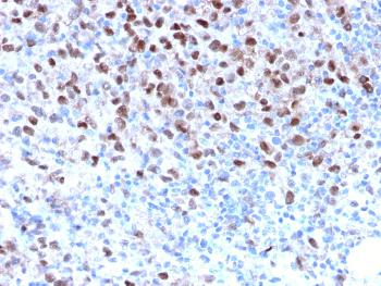 Anti-Microphthalmia Transcription Factor (MITF) Monoclonal Antibody(Clone: MITF/2987R)