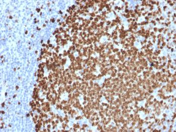 Anti-Ki-67 (Proliferating Cell Marker) Monoclonal Antibody(Clone: MKI67/2461)