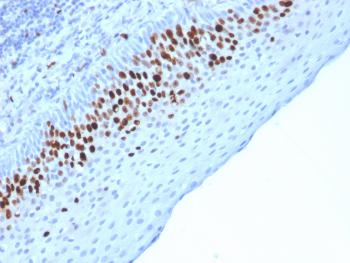 Anti-Ki-67 (Proliferating Cell Marker) Monoclonal Antibody(Clone: MKI67/2463)