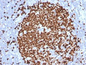 Anti-Ki-67 (Proliferating Cell Marker) Monoclonal Antibody(Clone: MKI67/2465)