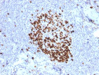 Anti-Ki-67 (Proliferating Cell Marker) Monoclonal Antibody(Clone: MKI67/2466)