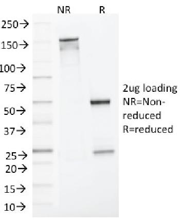 Anti-MLH1 (MutL Homolog 1) Monoclonal Antibody(Clone: MLH1/1324)