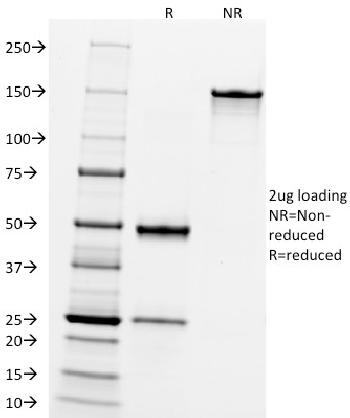 Anti-CD10 (Membrane Metalloendopeptidase) Monoclonal Antibody(Clone: FR4D11)