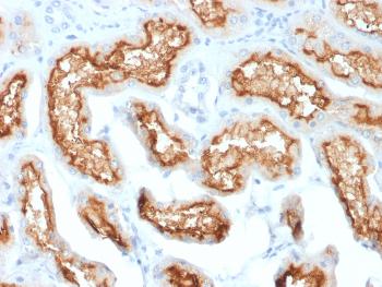 Anti-CD10 (Membrane Metalloendopeptidase) Monoclonal Antibody(Clone: MME/1870)