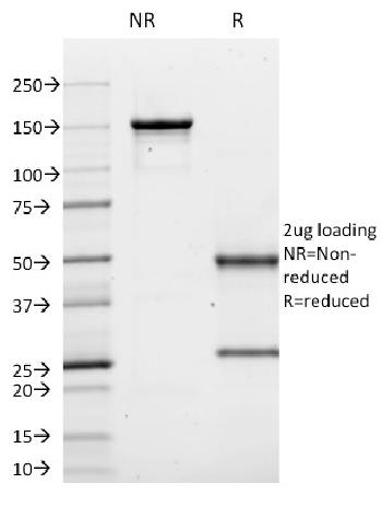 Anti-CD10 (Membrane Metalloendopeptidase) Monoclonal Antibody(Clone: MME/1620)