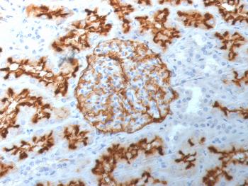 Anti-CD10 (Membrane Metalloendopeptidase) Monoclonal Antibody(Clone: MME/1892)