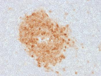 Anti-CD10 (Membrane Metalloendopeptidase) Monoclonal Antibody(Clone: MME/1893)