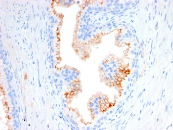 Anti-CD10 (Membrane Metalloendopeptidase) Monoclonal Antibody(Clone: MME/2580)