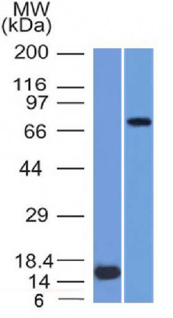 Anti-MMP2 / Collagenase Type IV A (Tumor Metastasis Marker) Monoclonal Antibody(Clone: MMP2/1501)