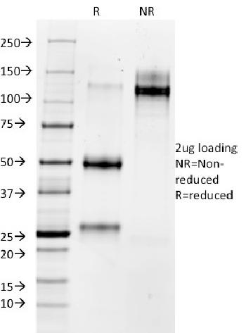 Anti-MMP3 (Marker of Metastasis and Rheumatoid Arthritis) Monoclonal Antibody(Clone: 1B4)