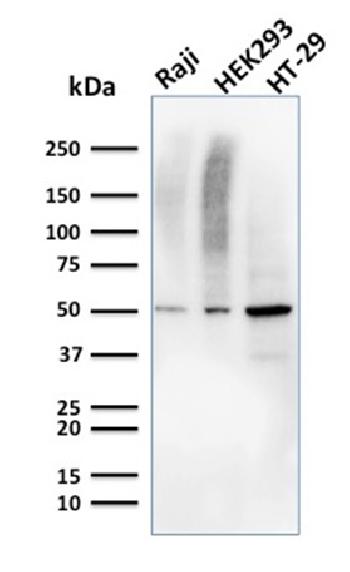 Anti-MMP3 (Marker of Metastasis and Rheumatoid Arthritis) Monoclonal Antibody(Clone: MMP3/2655)