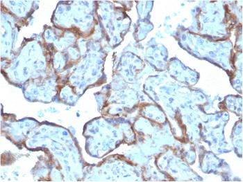 Anti-MMP3 (Marker of Metastasis and Rheumatoid Arthritis) Monoclonal Antibody(Clone: MMP3/2806)