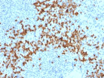 Anti-MMP9 (Matrix Metalloproteinase 9) Monoclonal Antibody(Clone: 2C3)