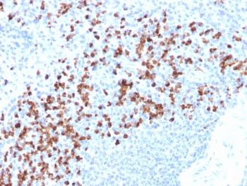 Anti-MMP9 (Matrix Metalloproteinase 9) Monoclonal Antibody(Clone: rMMP9/1769)