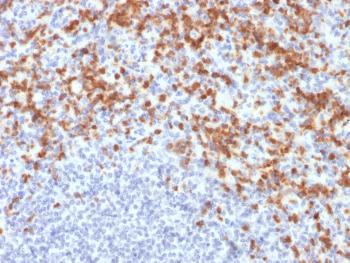 Anti-MMP9 (Matrix Metalloproteinase 9) Monoclonal Antibody(Clone: MMP9/2477)