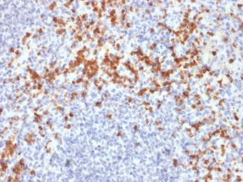 Anti-MMP9 (Matrix Metalloproteinase 9) Monoclonal Antibody(Clone: SPM425)