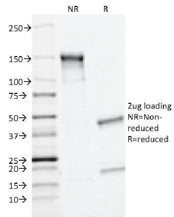 Anti-MRP1 / ABCC1 (Multidrug Resistance Related Protein 1) Monoclonal Antibody(Clone: MRP1/1343)