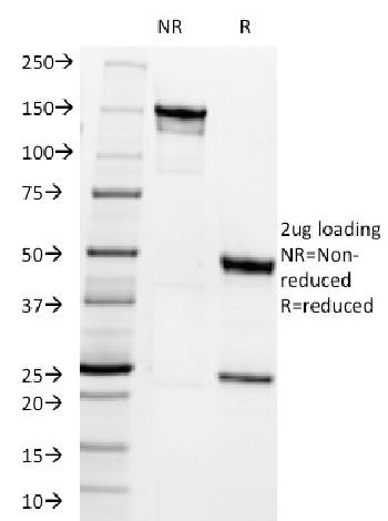 Anti-MRP1 / ABCC1 (Multidrµg Resistance Related Protein 1) Monoclonal Antibody(Clone: MRP1/1344)