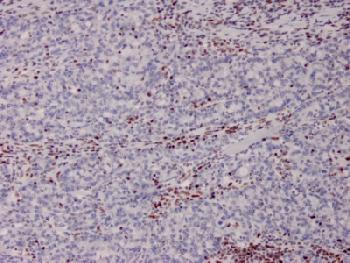 Anti-MSH2 (DNA Mismatch Repair Marker) Monoclonal Antibody(Clone: MSH2/2622)