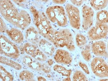 Anti-MTAP (Tumor Suppressor Marker) Monoclonal Antibody(Clone: MTAP/1813)