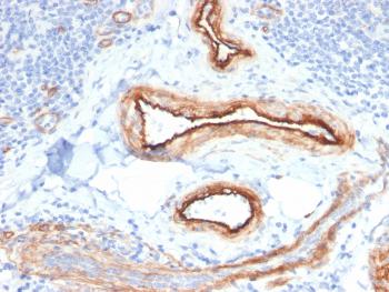 Anti-MTF1 Monoclonal Antibody(Clone: MTF1/2649)