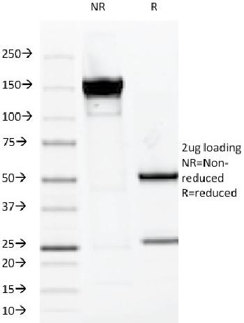 Anti-MUC1 / CA15-3 / EMA / CD227 (Epithelial Marker) Monoclonal Antibody(Clone: VU-2G7)