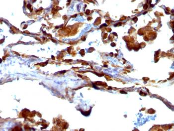 Anti-MUC1 / CA15-3 / EMA / CD227 (Epithelial Marker) Monoclonal Antibody(Clone: VU-4H5)