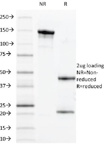 Anti-MUC1 / CA15-3 / EMA / CD227 (Epithelial Marker) Monoclonal Antibody(Clone: VU-11D1)