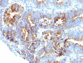 Anti-MUC1 / CA15-3 / EMA / CD227 (Epithelial Marker) Monoclonal Antibody(Clone: SPM493)