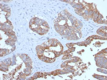 Anti-MUC1 / CA15-3 / EMA / CD227 (Epithelial Marker) Monoclonal Antibody(Clone: MUC1/2729R)