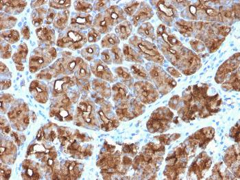 Anti-MUC1 / CA15-3 / EMA / CD227 (Epithelial Marker) Monoclonal Antibody(Clone: MUC1/2818R)