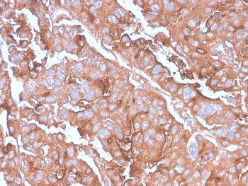 Anti-MUC1 / CA15-3 / EMA / CD227 (Epithelial Marker) Monoclonal Antibody(Clone: MUC1/2980R)