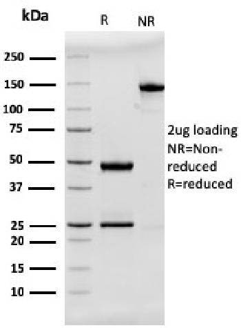 Anti-MUC2 (Mucin 2) Monoclonal Antibody(Clone: rMLP/842)