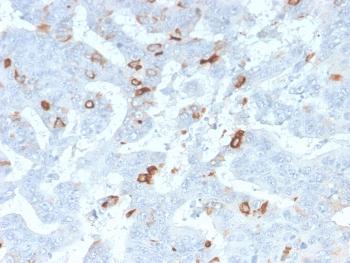 Anti-MUC2 (Mucin 2) Monoclonal Antibody(Clone: MLP/2970R)